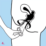 Femidom does not restrict the penis